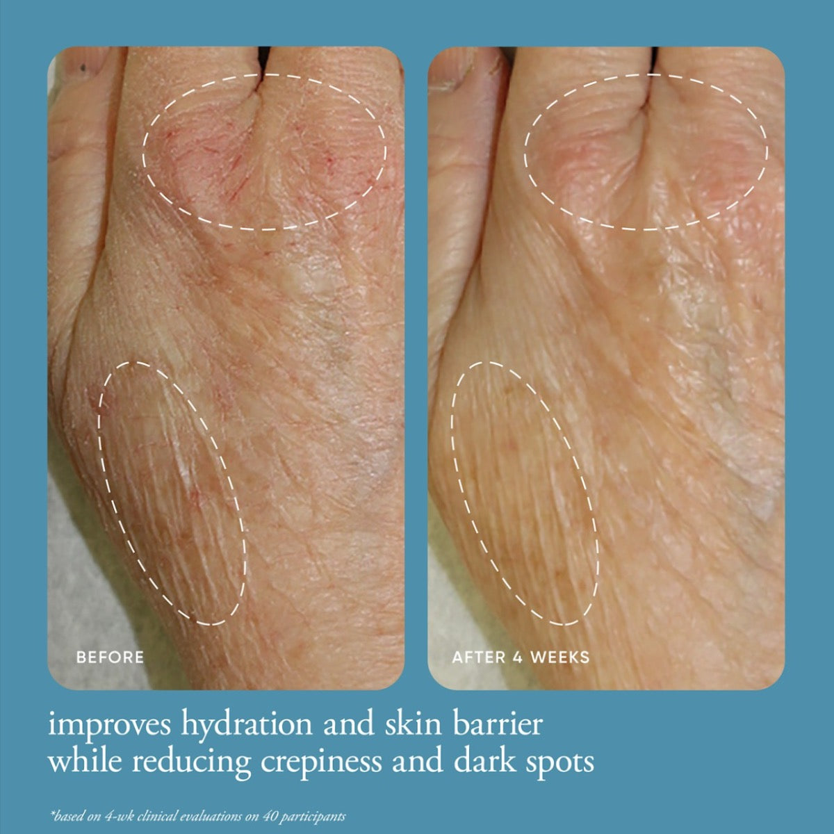 Before and after images showing improved skin hydration and reduced dark spots after using Philosophy multi-restorative hand cream for 4 weeks