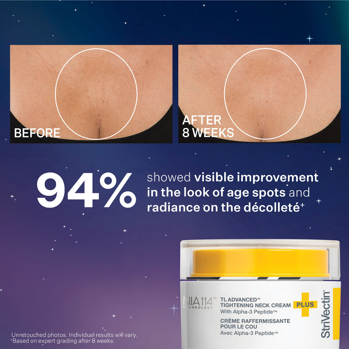 StriVectin TL Advanced Tightening Neck Cream with visible results shown after 8 weeks of use