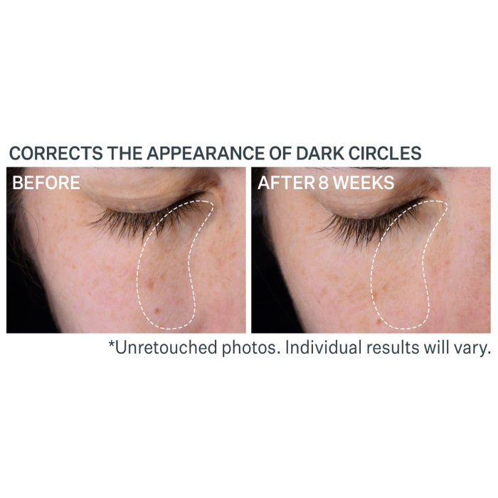 StriVectin Multi-Action Super-C Dark Circle Brightening Eye Serum 0.50oz