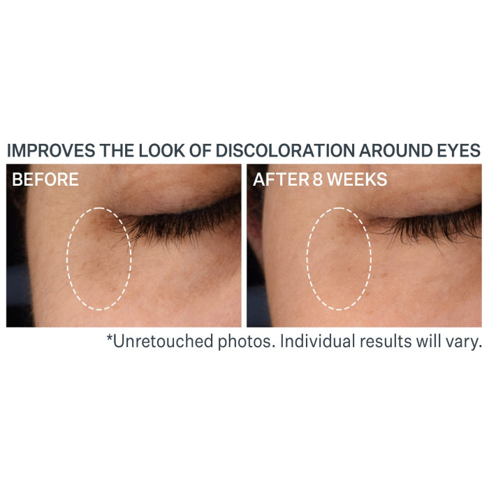 StriVectin Multi-Action Super-C Dark Circle Brightening Eye Serum 0.50oz