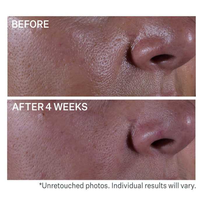 StriVectin Multi-Action Super Shrink Pore Minimizing Serum 1.0oz