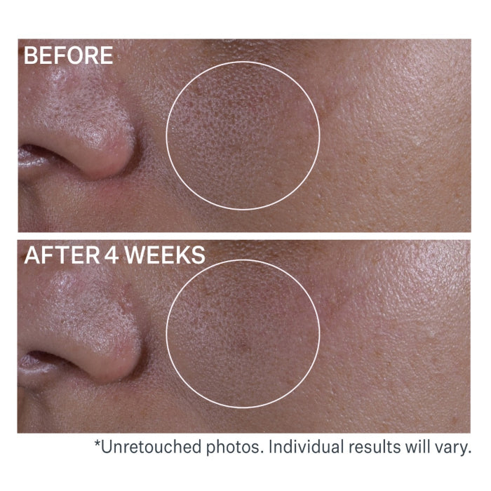 StriVectin Multi-Action Super Shrink Pore Minimizing Serum 1.0oz