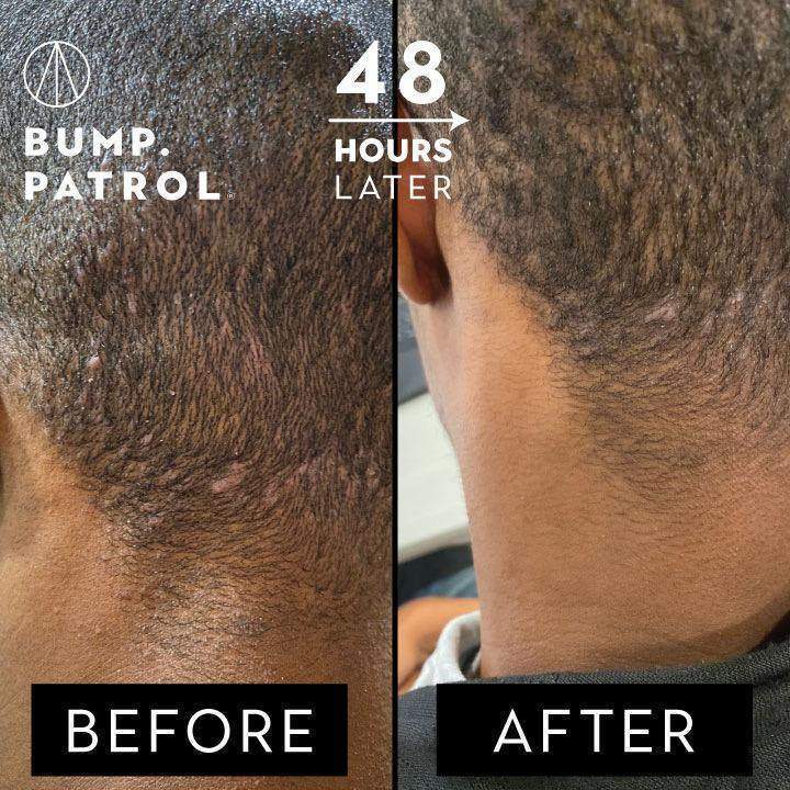 Patrol Grooming Bump Patrol After Shave Sensitive 2 oz-Patrol Grooming-Bath and Body_Men,BB_Bath and Shower,Brand_Patrol Grooming,Collection_Bath and Body,Collection_Skincare,Concern_Sensitive Skin,PATROL_Aftershave,Skincare_Men