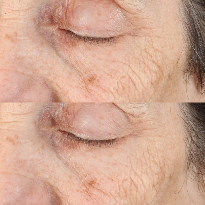 perricone md acyl glutathione deep crease serum reviews Perricone MD Essential Fx Acyl-Glutathione Deep Crease Serum – Face and Body Shoppe perricone md acyl glutathione deep crease serum reviews Perricone MD Essential Fx Acyl-Glutathione Deep Crease Serum – Face and Body Shoppe