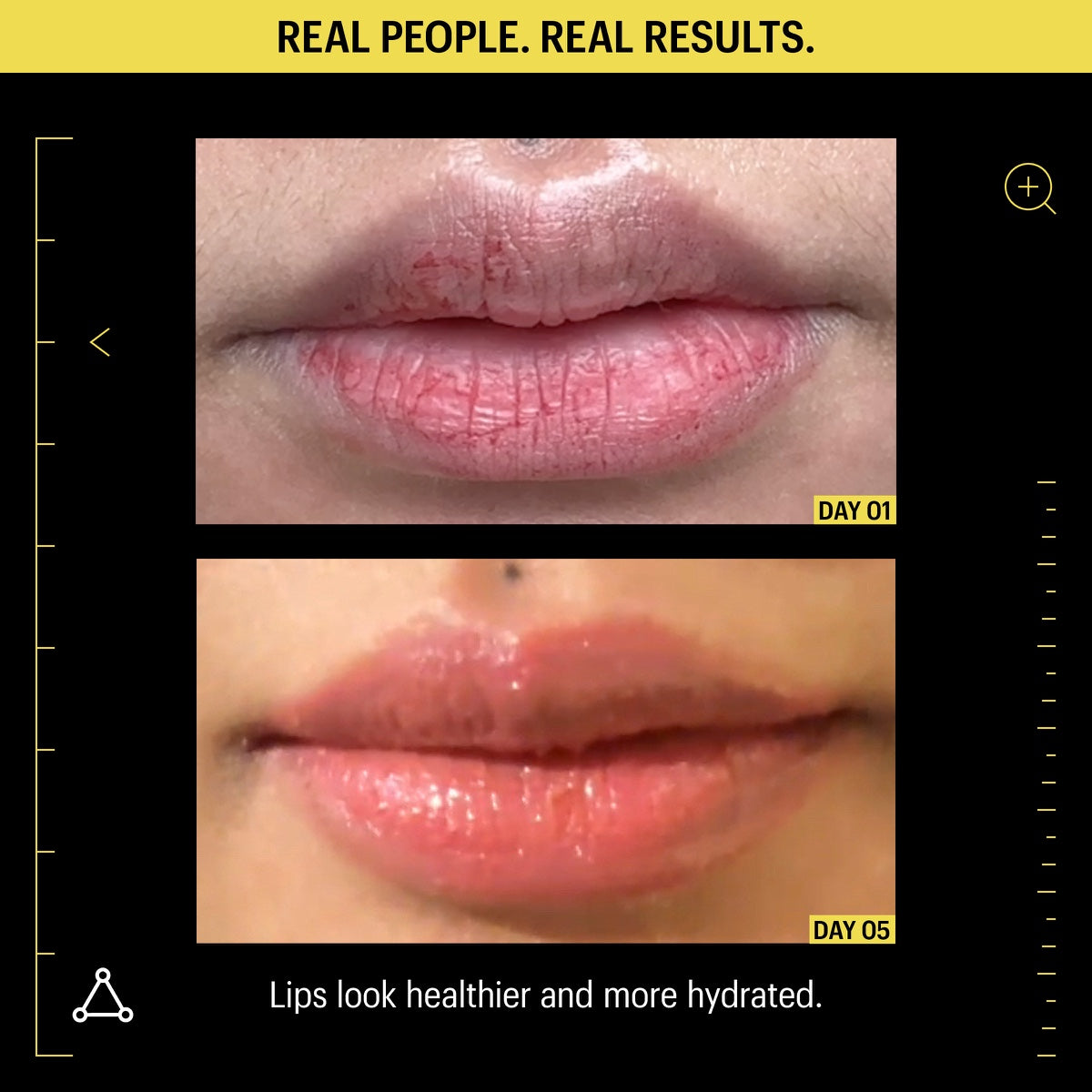 Before and after closeup of lips Day 01 to Day 05 showing hydrated repair using Allies of Skin lip repair balm