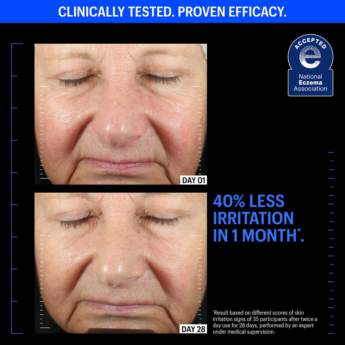 copper tripeptide repair serum before and after close up of older woman showing 40 percent less irritation in 1 month