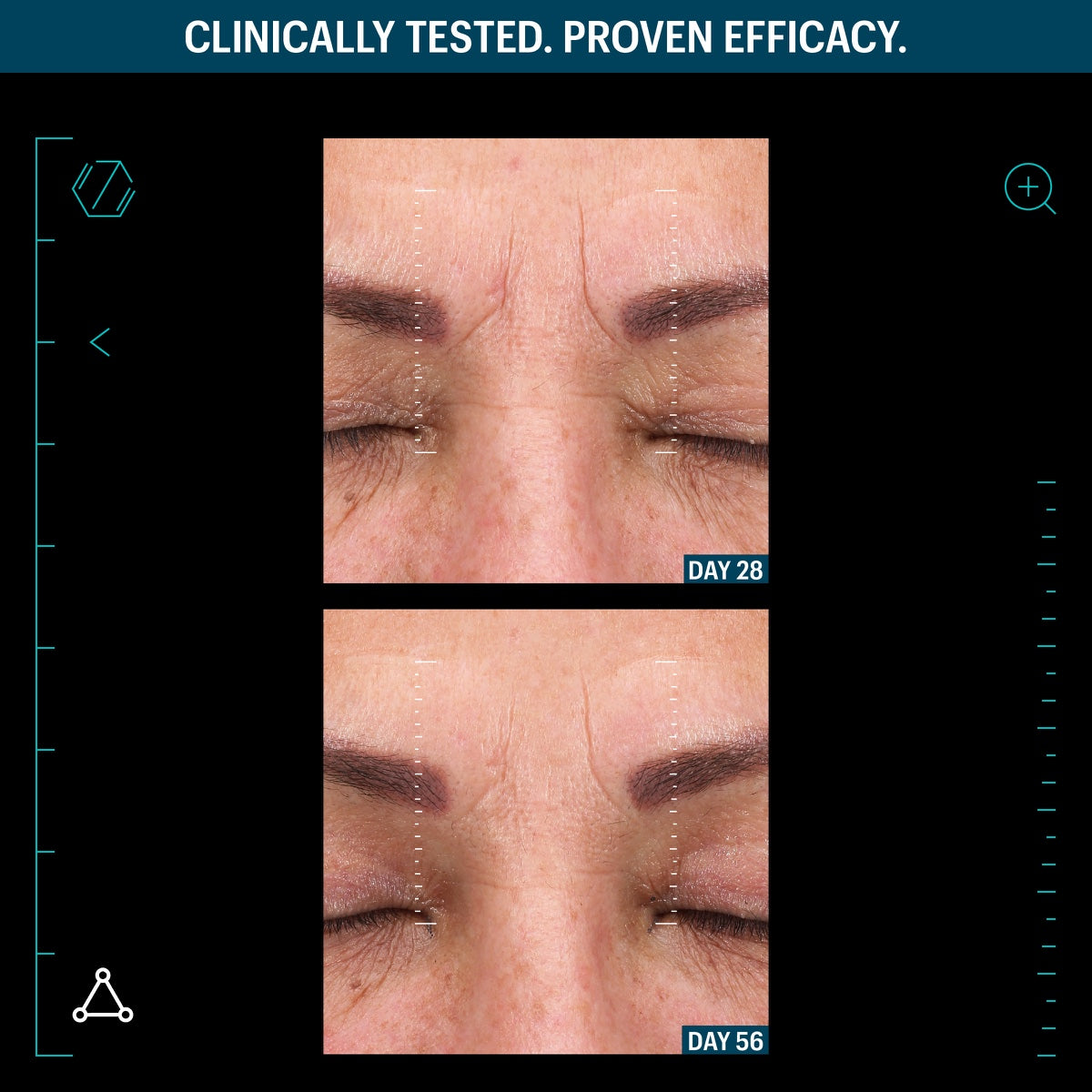 Allies of Skin multi peptide lifting serum before and after close up forehead and eye showing fewer frown lines day 28 56