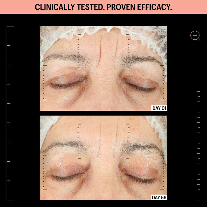 Before and after showing reduced forehead and eyelid wrinkles day 01 to 56 using peptide firming moisturizer