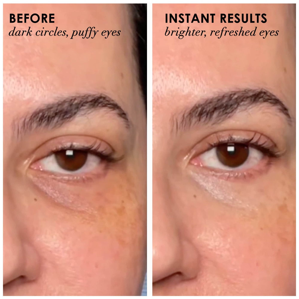 Before and after eye close ups showing reduced puffiness and lighter under eye circles using Dermelect Revitalite for dark circles