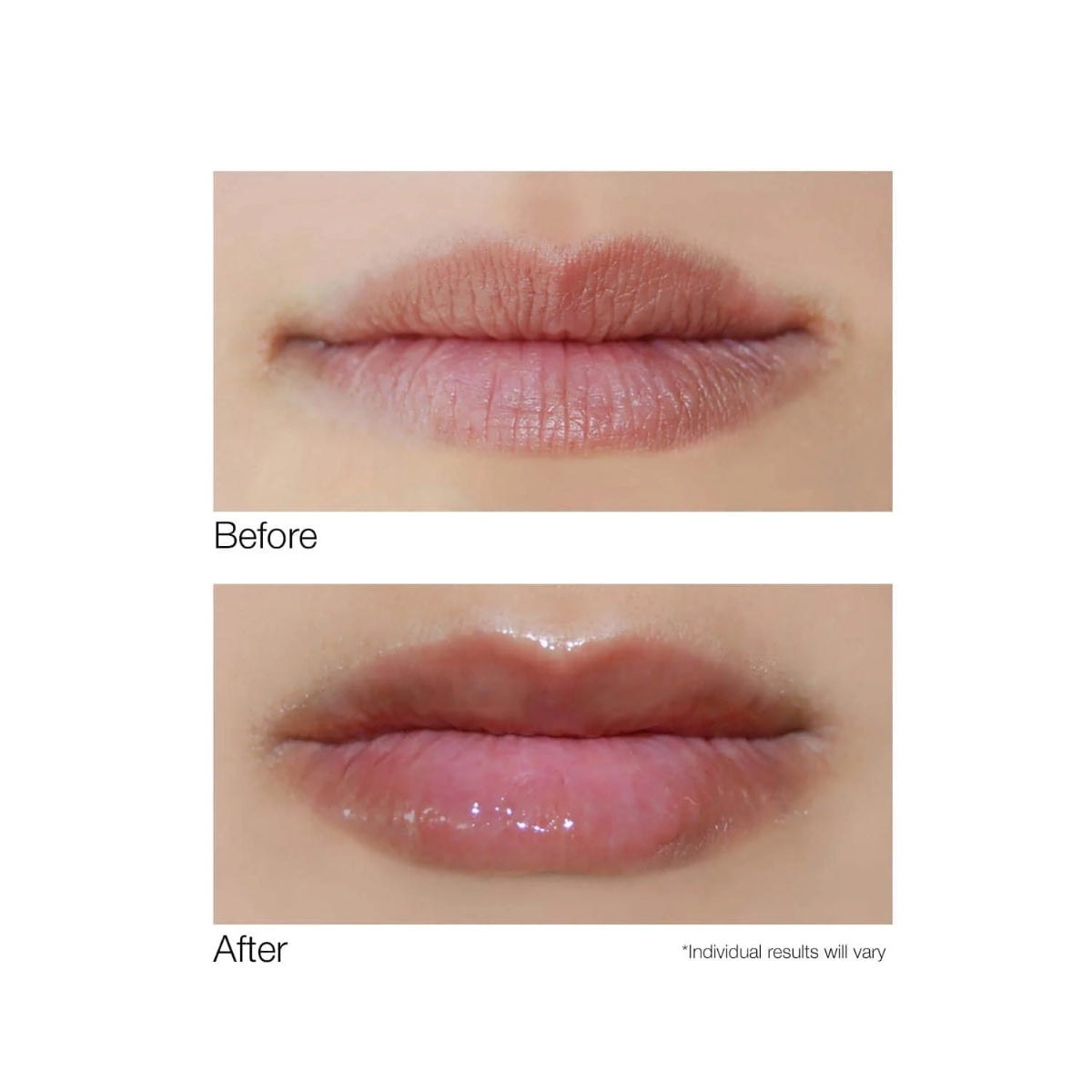 Dermelect before and after close up of lips showing glossy plumping effect using lip volumizer for fuller lips