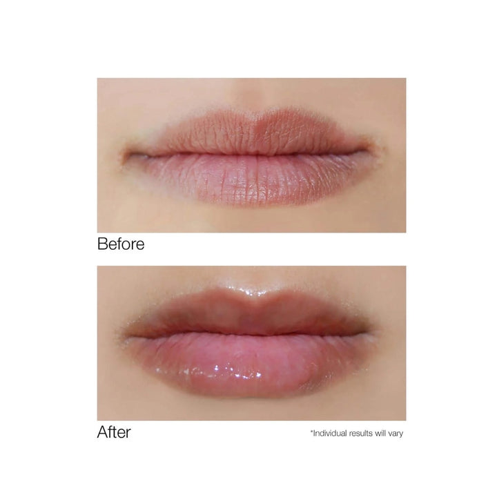 Dermelect before and after close up of lips showing glossy plumping effect using lip volumizer for fuller lips