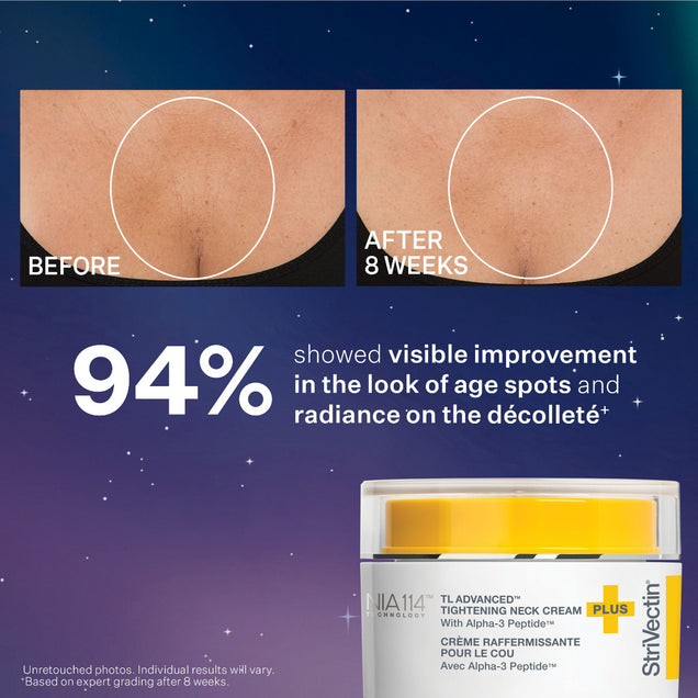 StriVectin TL Advanced Tightening Neck Cream with visible results shown after 8 weeks of use