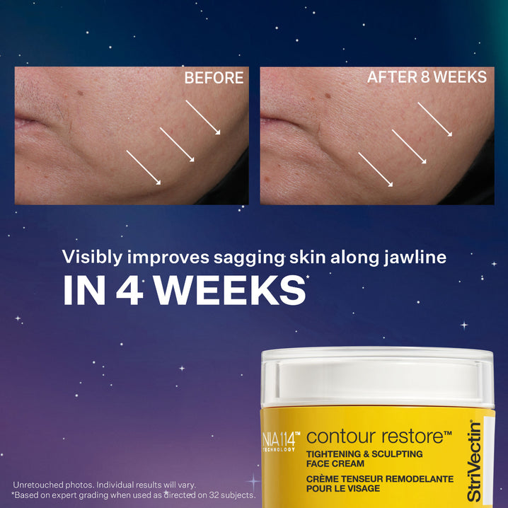 StriVectin Contour Restore Face Cream visibly improves sagging skin along jawline in 4 weeks