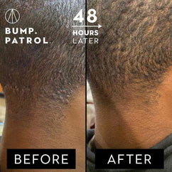 Patrol Grooming Bump Patrol After Shave - Max Strength  2oz-Patrol Grooming-Bath and Body_Men,BB_Bath and Shower,Brand_Patrol Grooming,PATROL_Aftershave,Skincare_Men