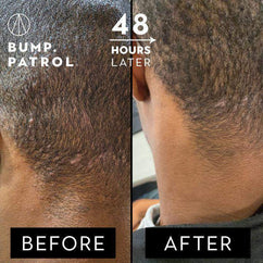 Patrol Grooming Bump Patrol After Shave Sensitive  2 oz-Patrol Grooming-Bath and Body_Men,BB_Bath and Shower,Brand_Patrol Grooming,Collection_Bath and Body,Collection_Skincare,Concern_Sensitive Skin,PATROL_Aftershave,Skincare_Men